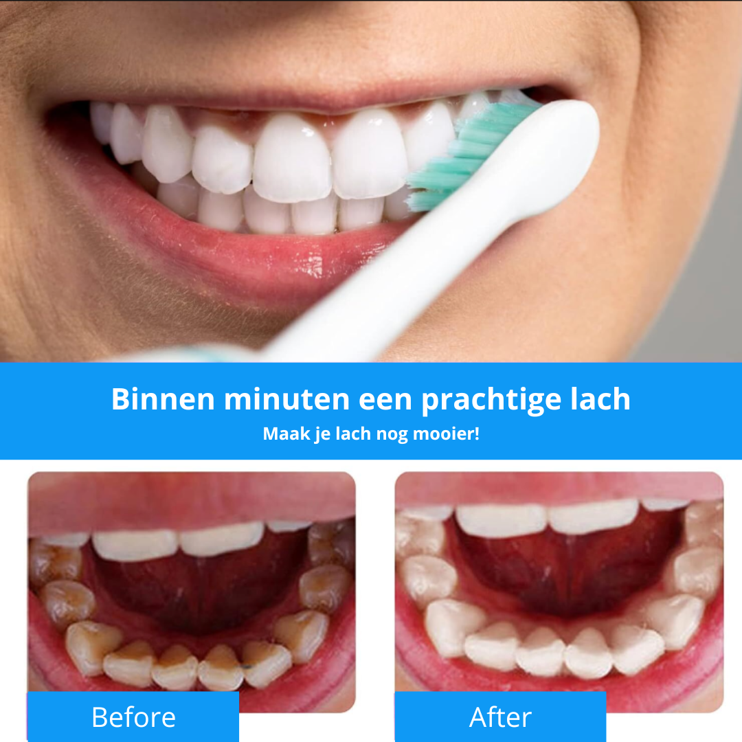 WhiteSmile | Ein strahlendes Lächeln in Minuten | Kombiangebot