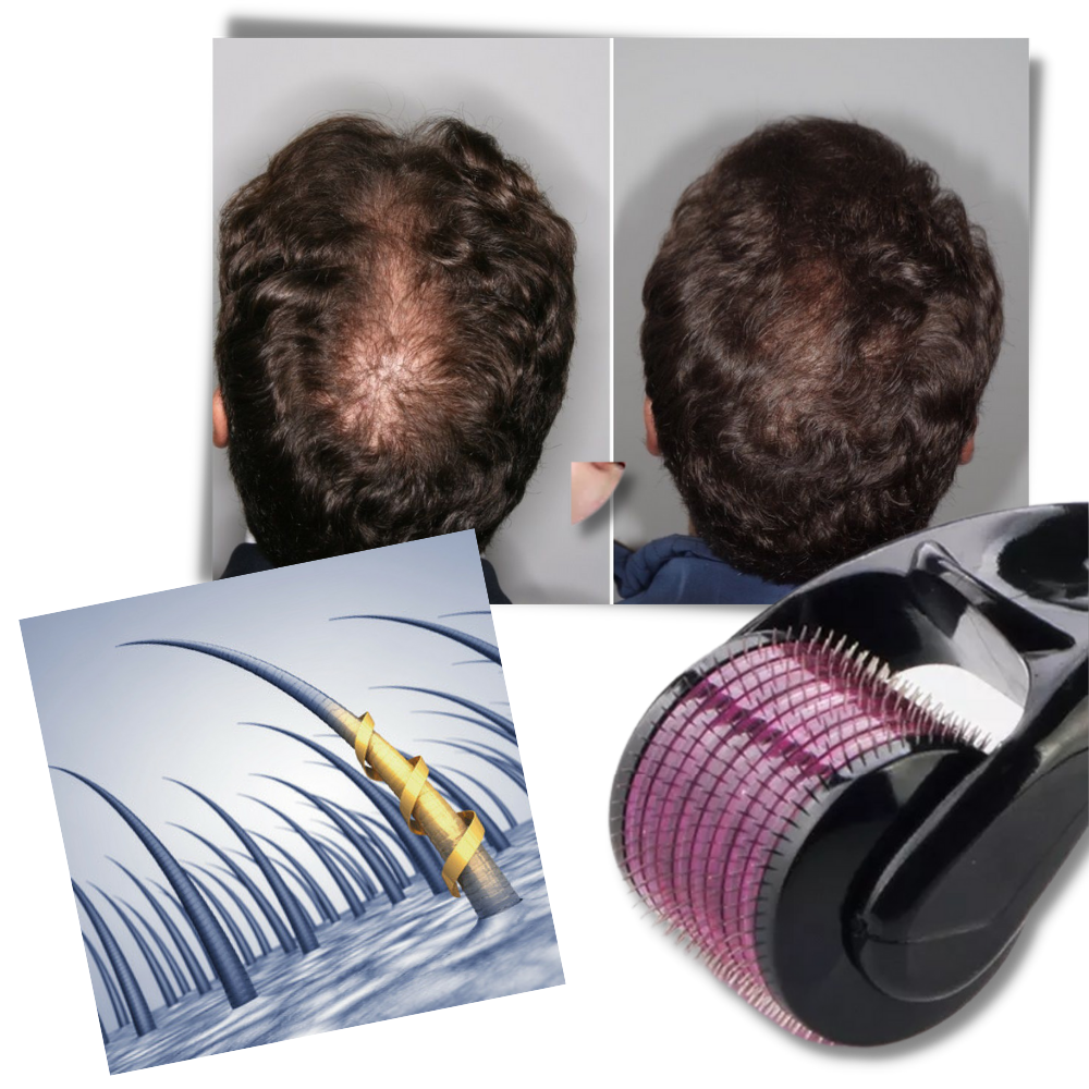 Derma-Roller für Haar- und Bartwachstum