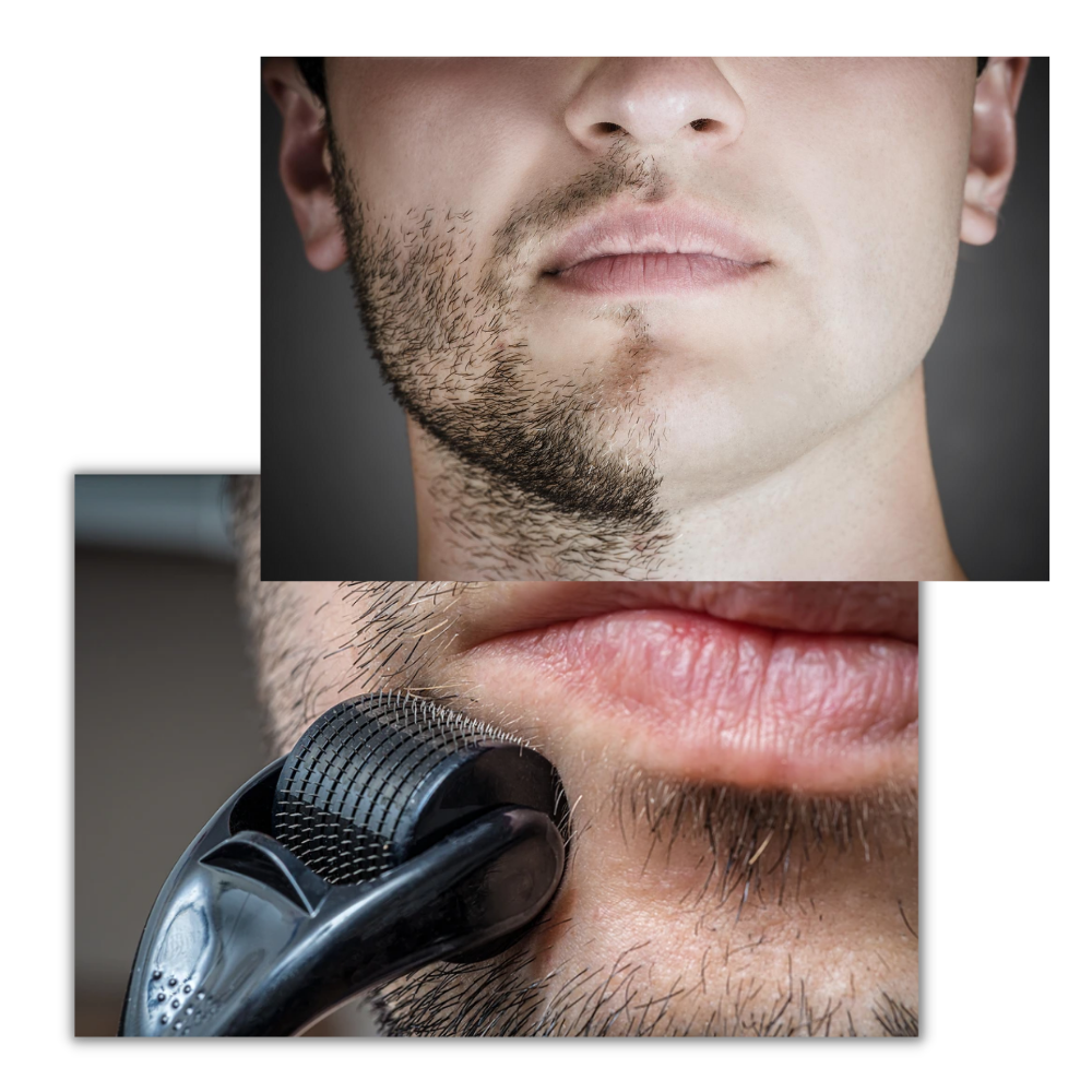 Derma-Roller für Haar- und Bartwachstum