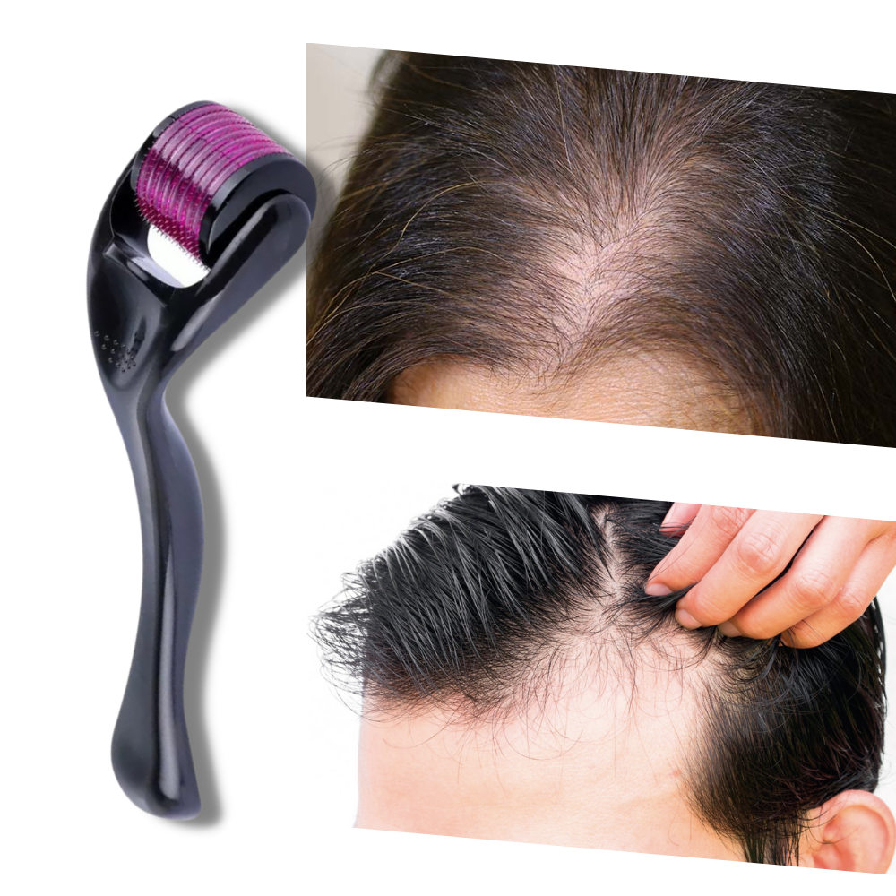 Derma-Roller für Haar- und Bartwachstum