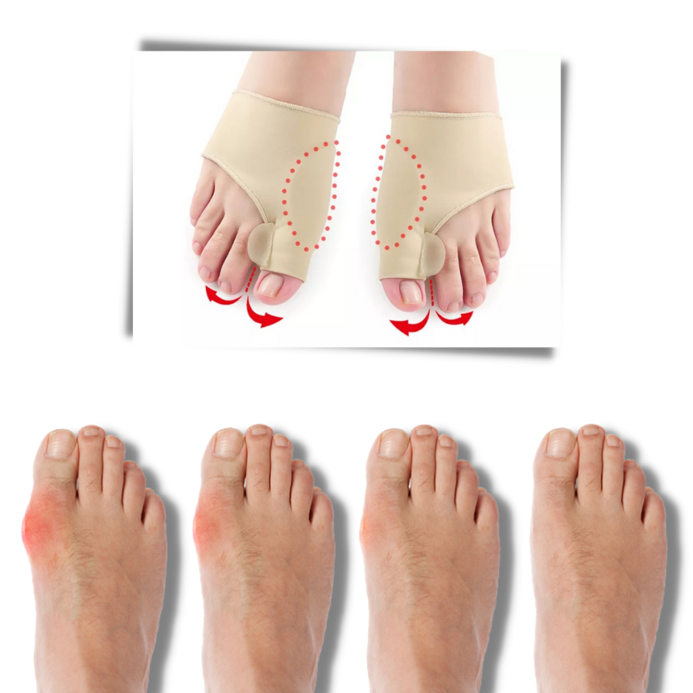 Gel Bunion-Korrektor