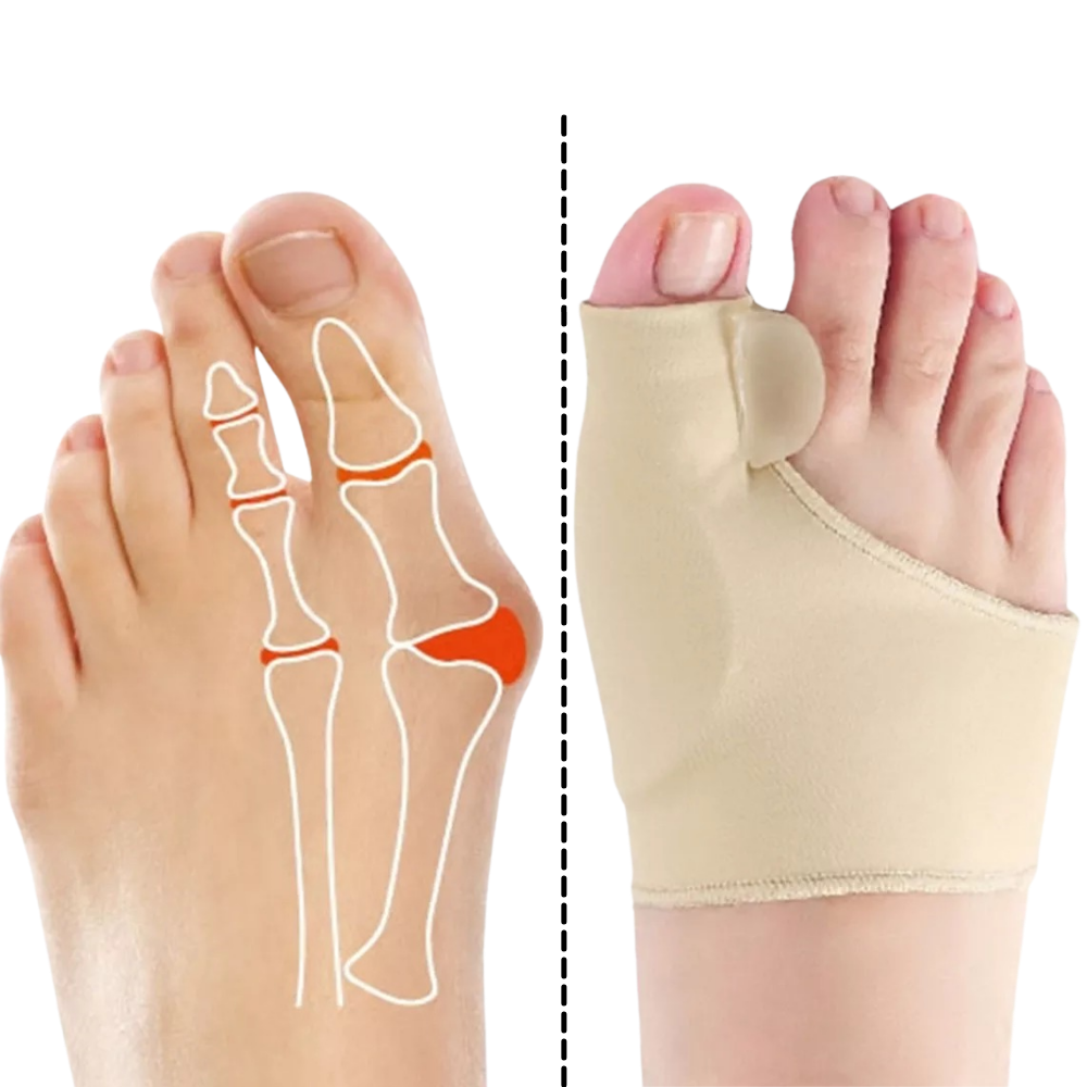 Gel Bunion-Korrektor