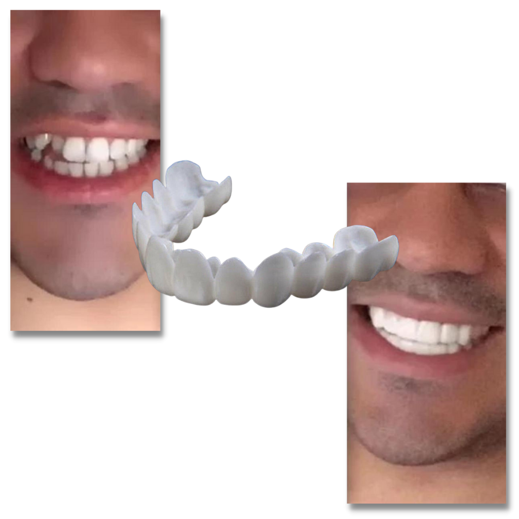 Perfektes Lächeln Zahnversicherung - bequeme Veneers