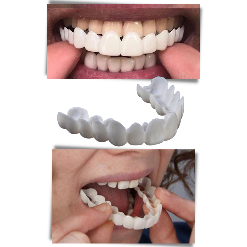 Perfektes Lächeln Zahnversicherung - bequeme Veneers