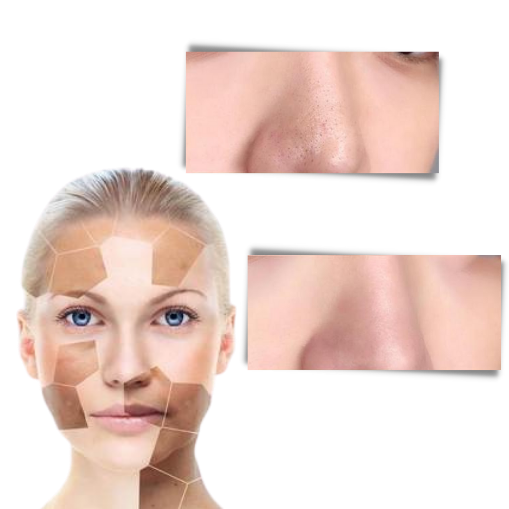 Poreless tiefenreinigende Entfernen von Mitessern Grüntee-Maske