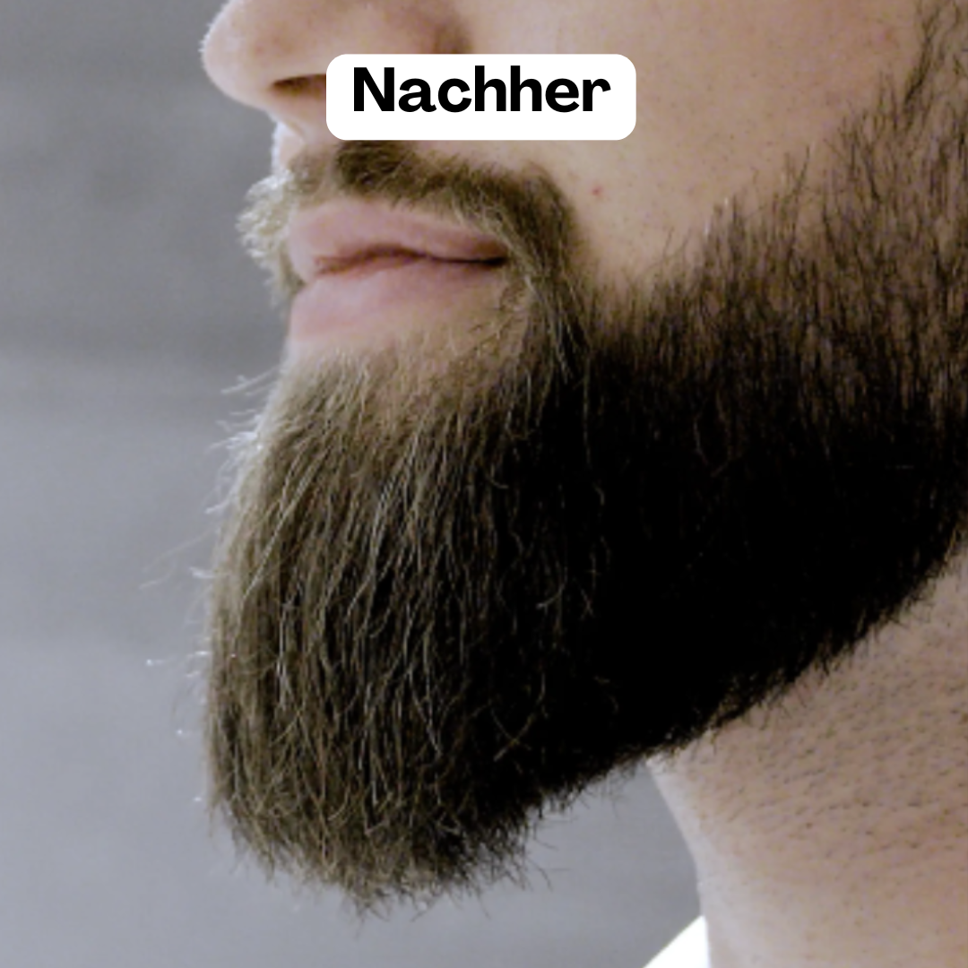 BeardMaster | Kabelloser negativer Ion-Bartstyler