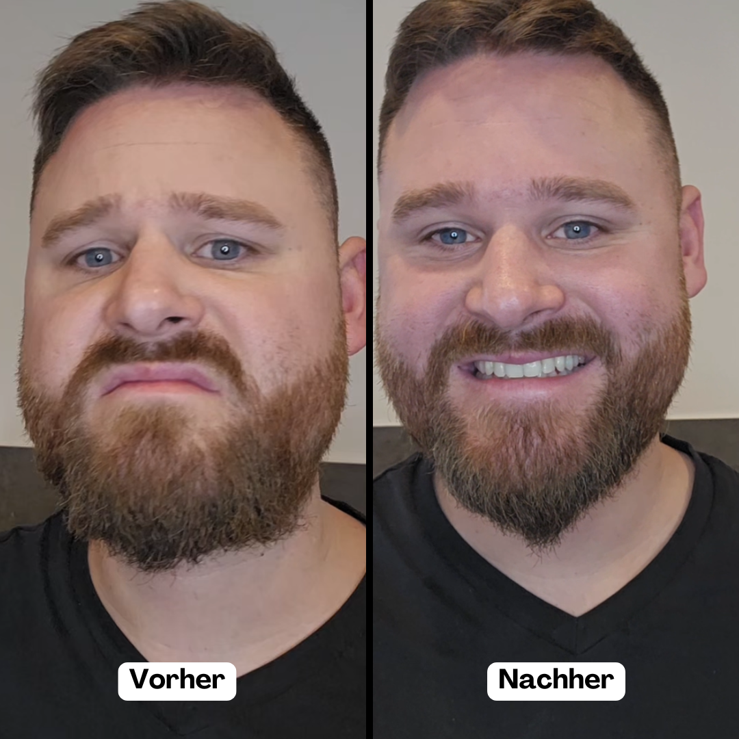 BeardMaster | Kabelloser negativer Ion-Bartstyler