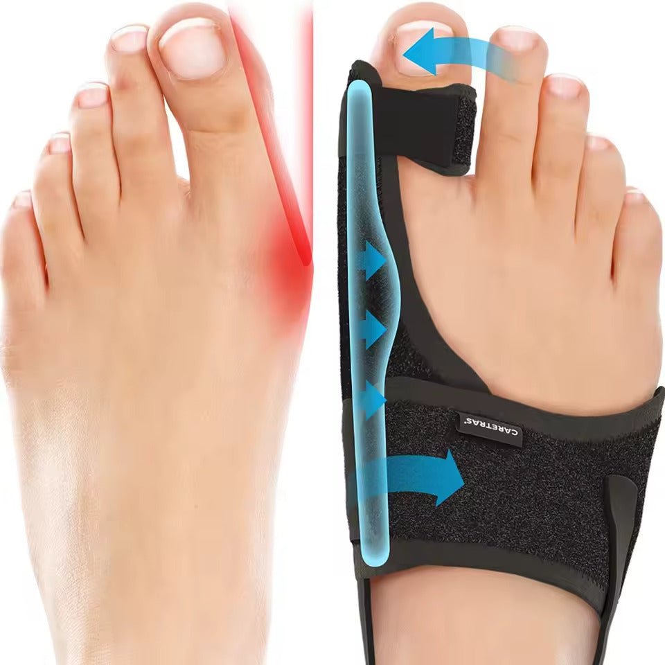 Nachtspalk Hallux Valgus - Ergonomisch und Verstellbar Komfort