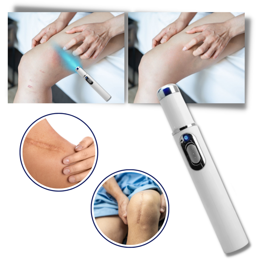 Dunkelheitsflecken Entferner Blauer Laser Stift
