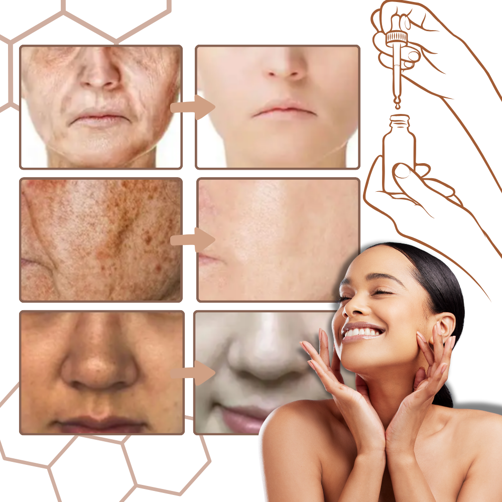 Nicht fettendes Melanin-korrigierendes Gesichtsserum