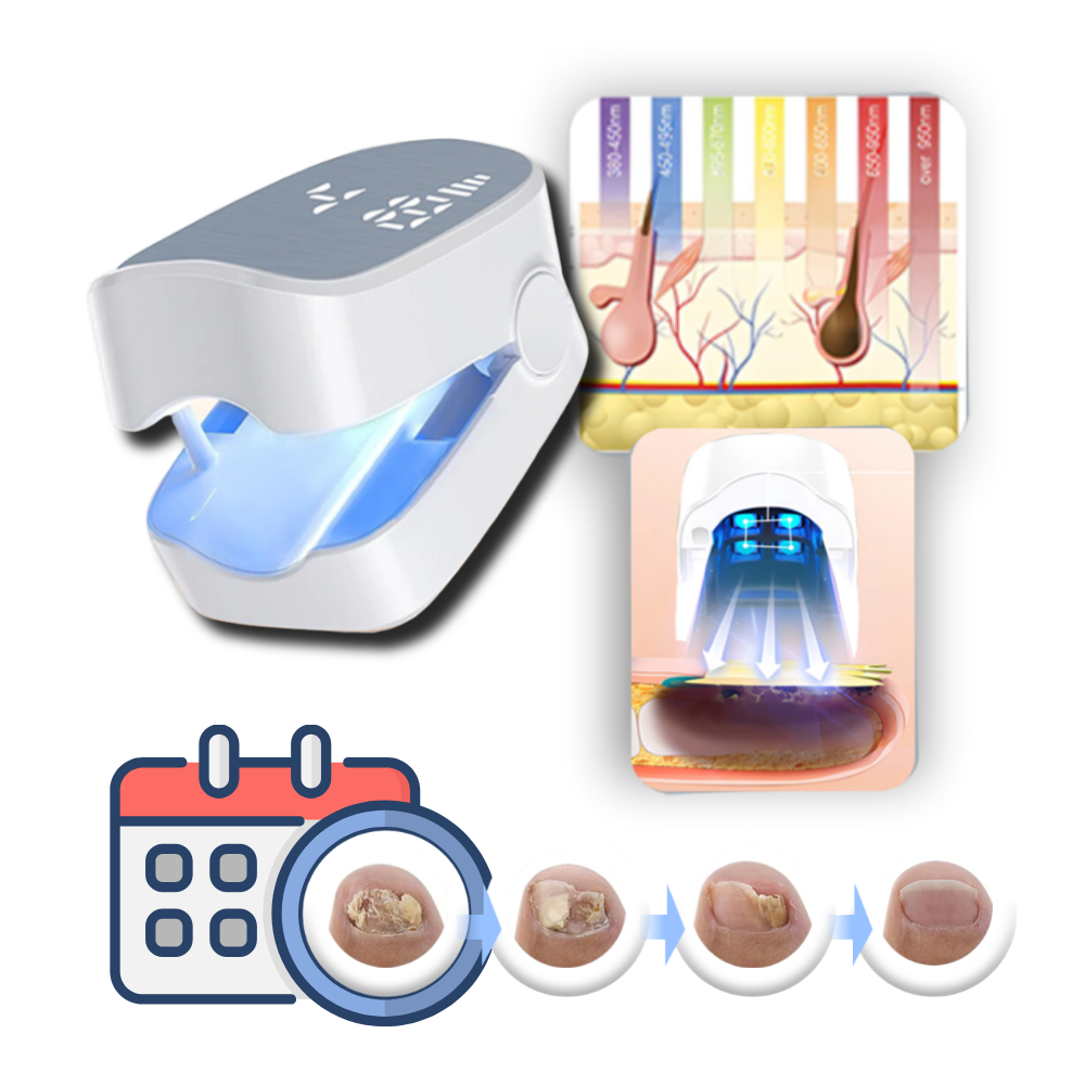 Schmerzfreier Nagelpilzlaser