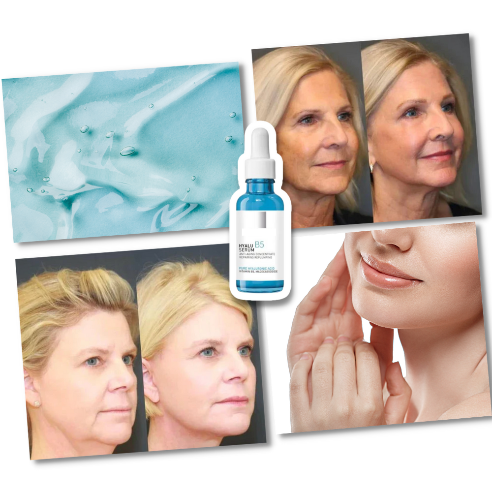 Verjüngendes Hyalu B5 Hyaluronsäure-Serum