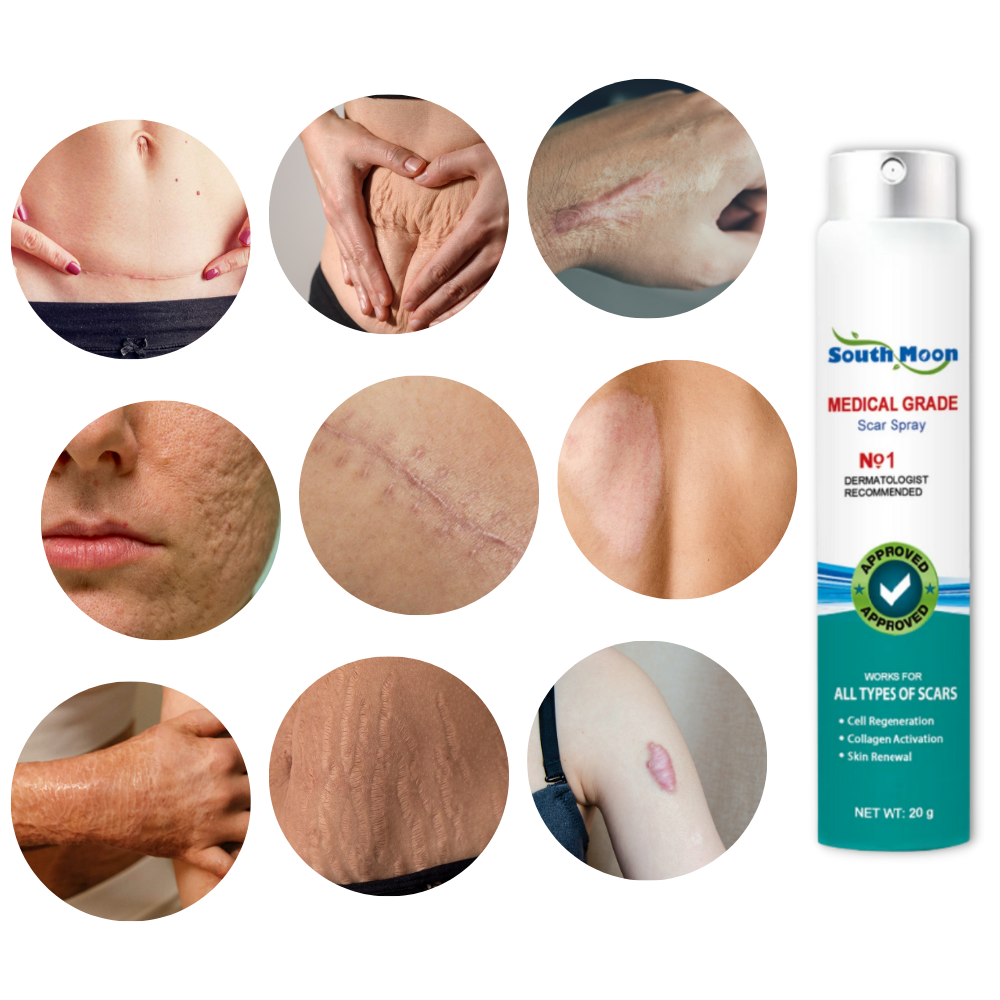 Narbenentfernungs-Spray-Therapie