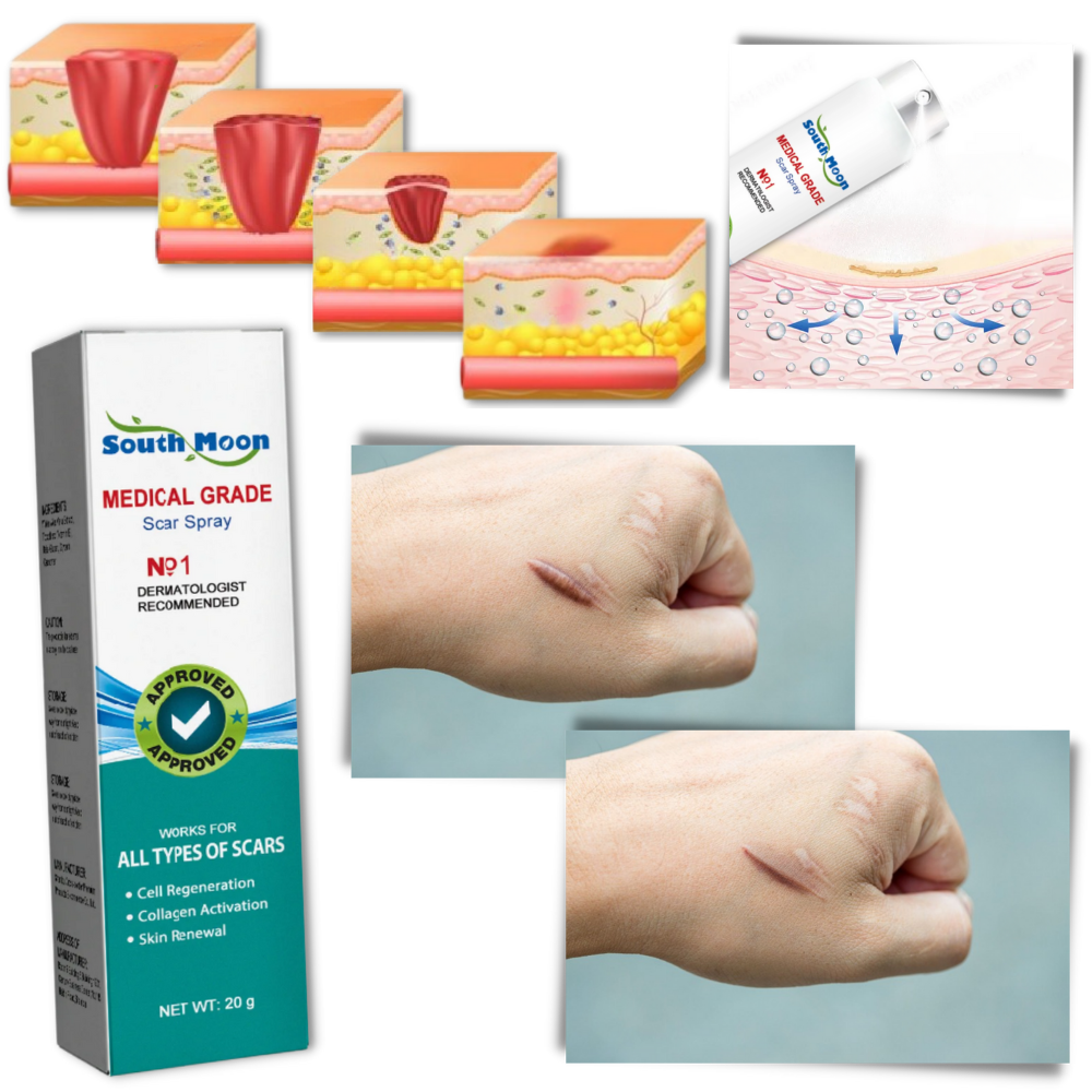 Narbenentfernungs-Spray-Therapie