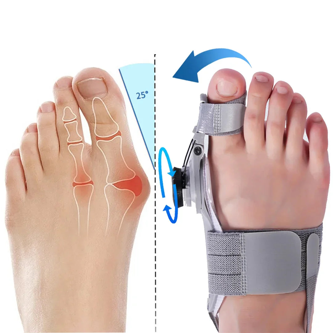 AlignEase Hallux Valgus Korrektor | Komfort und Ausrichtung für gesunde Füße