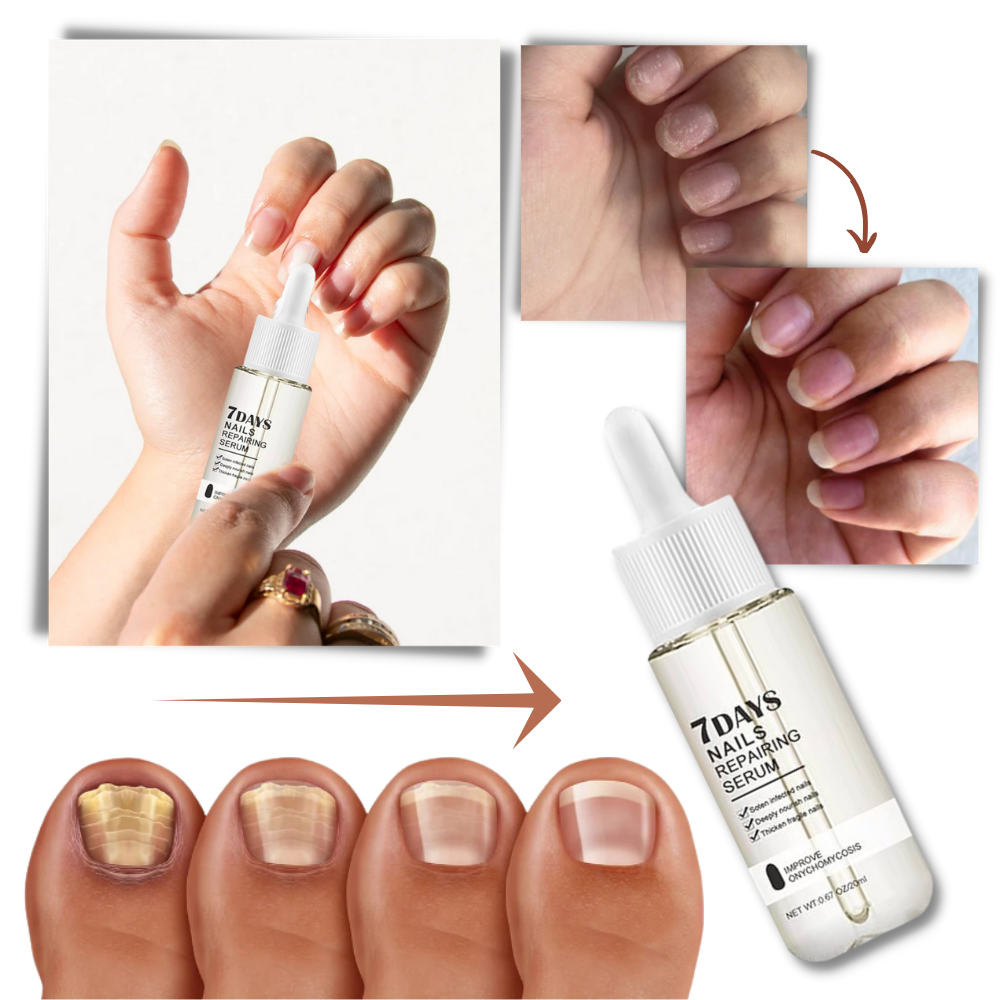 7 Tage Nagelreparatur-Essenz