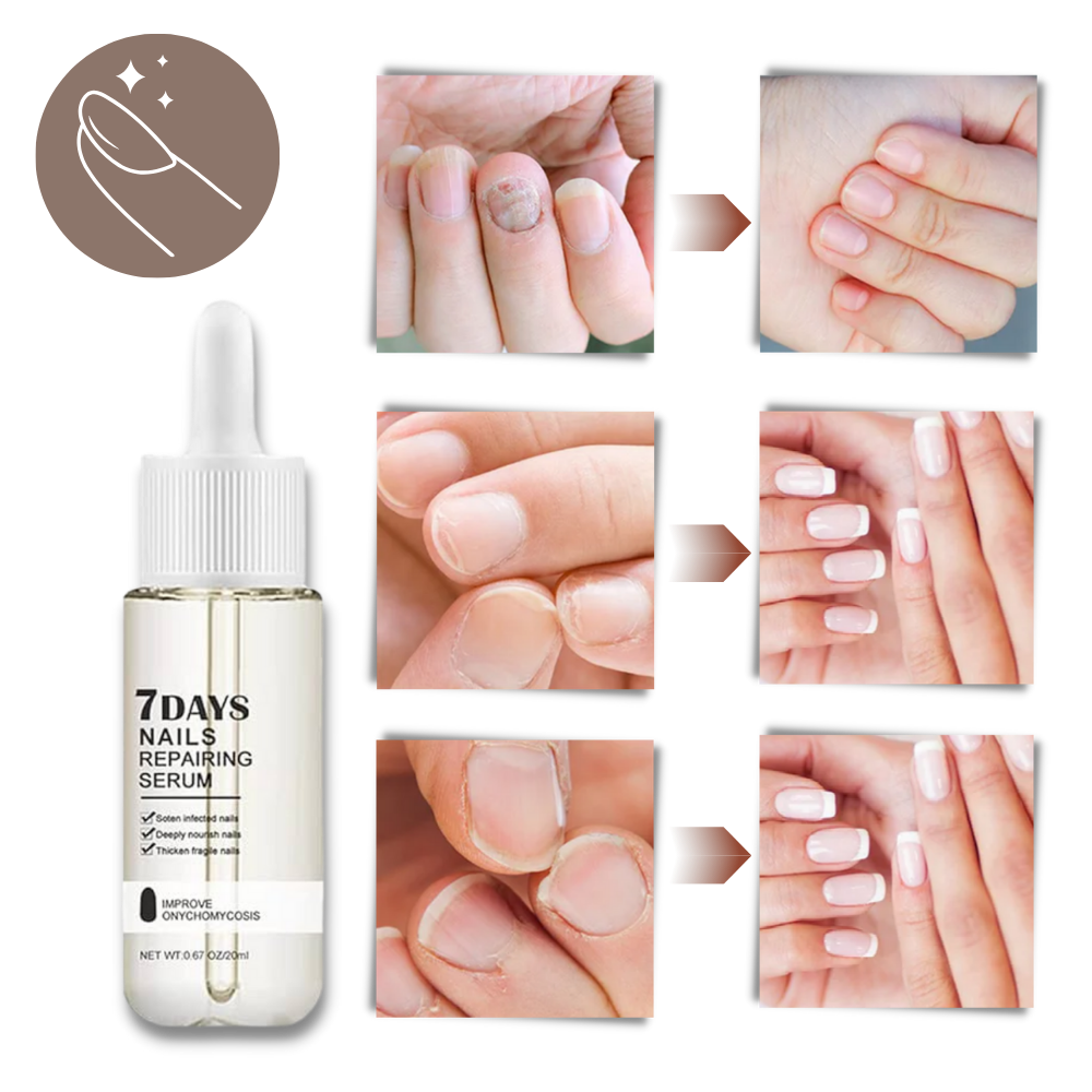 7 Tage Nagelreparatur-Essenz