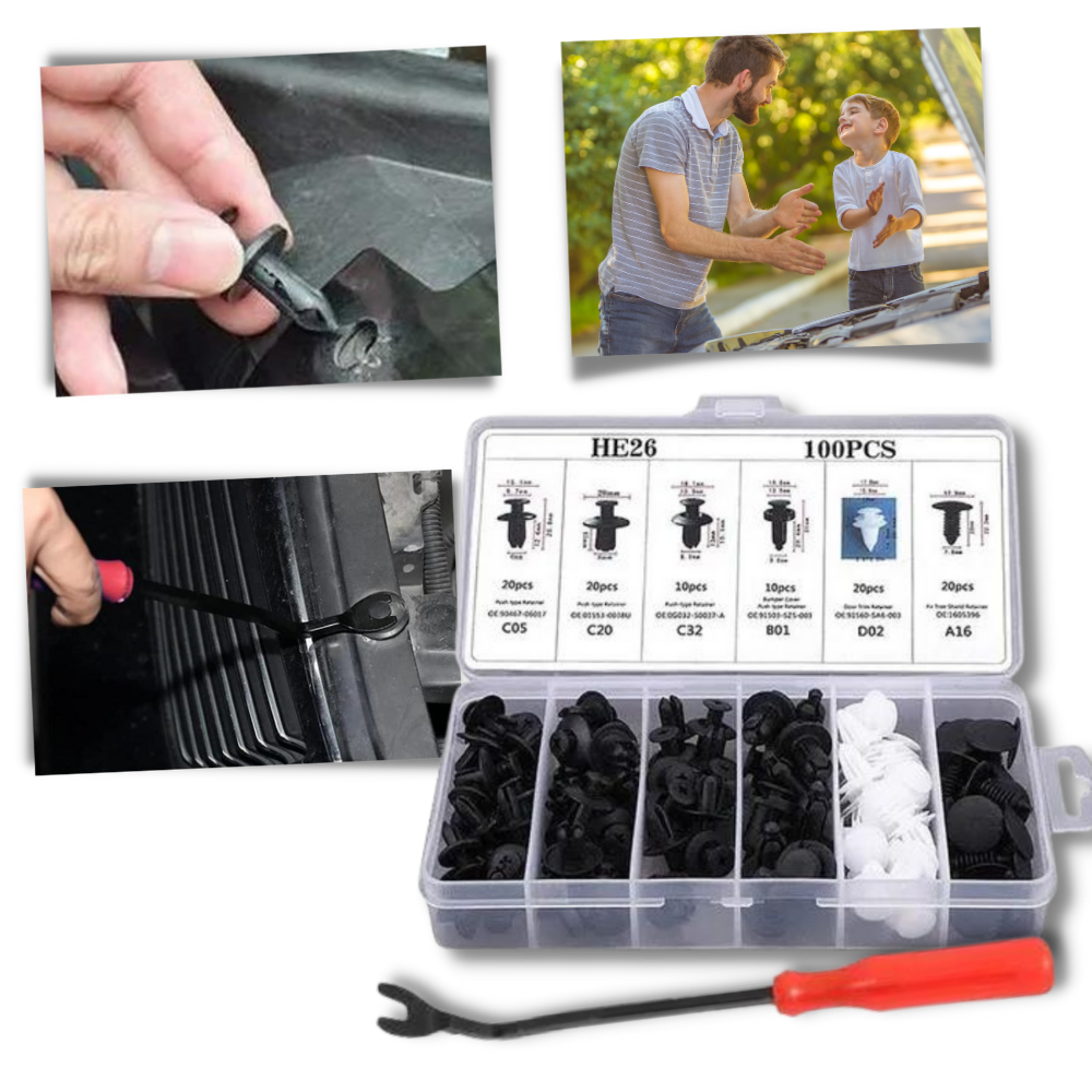 Set von Türverkleidungsclips für Autos