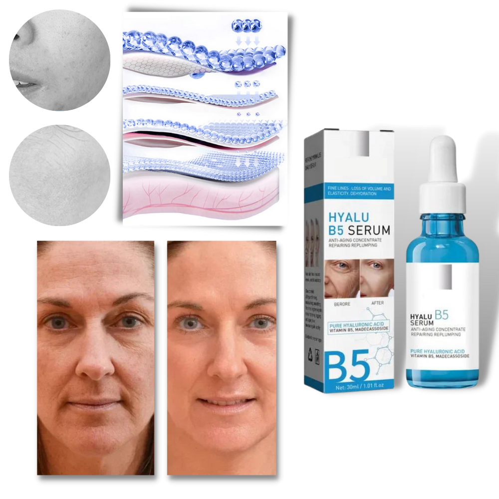 Verjüngendes Hyalu B5 Hyaluronsäure-Serum