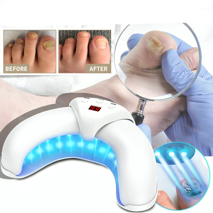 LuxeNail | Antischimmelbehandlung für Nägel – effektiv – schnell – natürlich